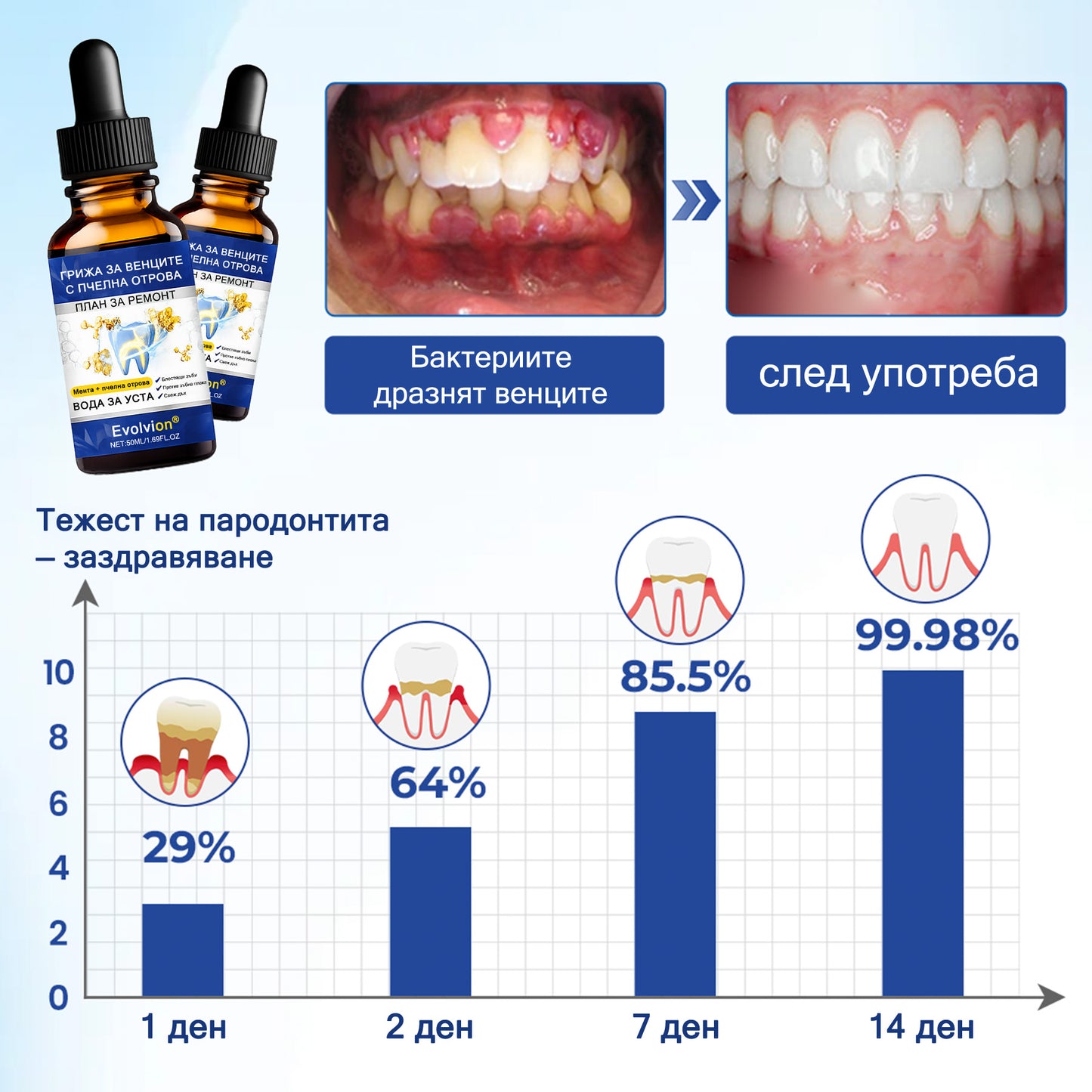 🦷 Evolvion® VioGloss терапия за устна хигиена с пчелна отрова 🦷 (🇧🇬 Одобрено от Българската дентална асоциация)
