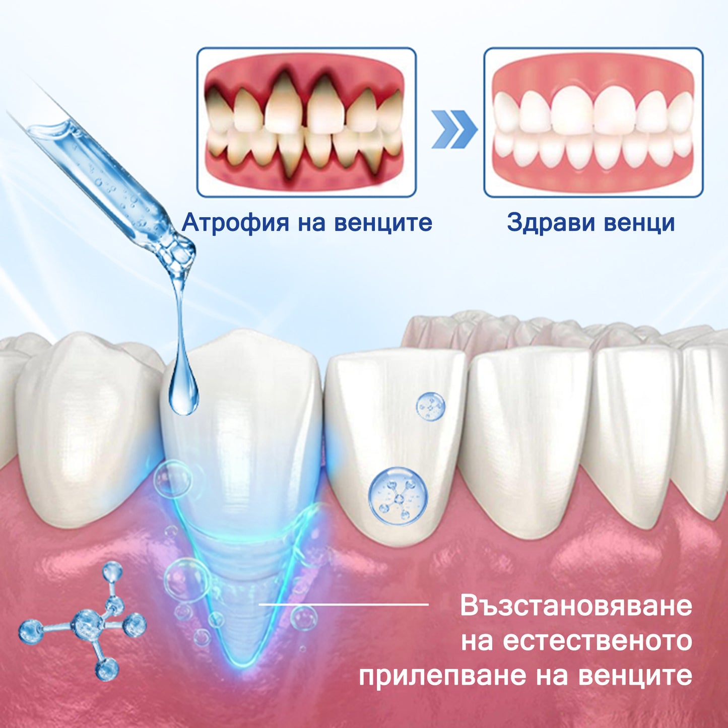🦷 Evolvion® VioGloss терапия за устна хигиена с пчелна отрова 🦷 (🇧🇬 Одобрено от Българската дентална асоциация)
