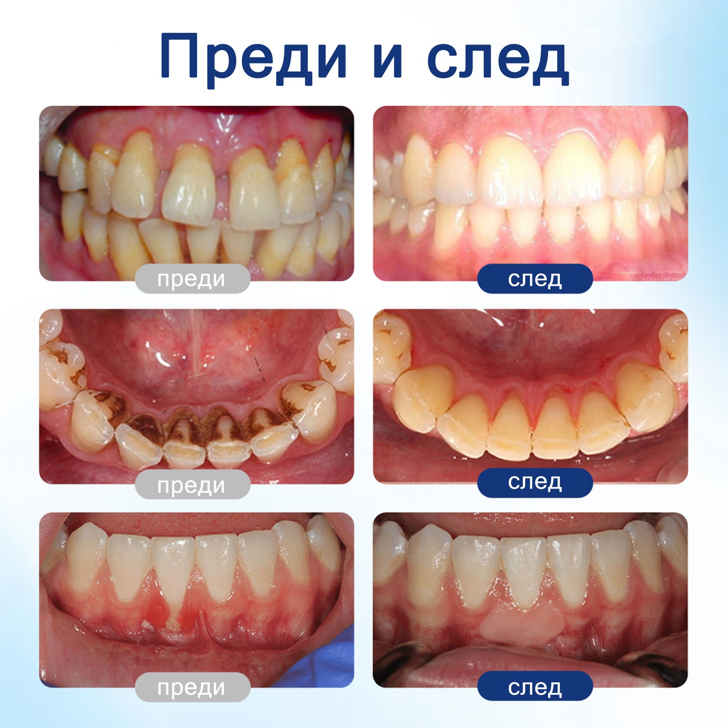 🦷 Evolvion® VioGloss терапия за устна хигиена с пчелна отрова 🦷 (🇧🇬 Одобрено от Българската дентална асоциация)