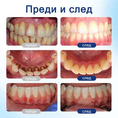 🦷 Evolvion® VioGloss терапия за устна хигиена с пчелна отрова 🦷 (🇧🇬 Одобрено от Българската дентална асоциация)