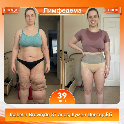 🍌Официален магазин на марката |🍀🍀 GFOUK® 2026 MORINGA И BERBERINE 4 В 1 МИКРОЧАСТИЧНО ОФОРМЯНЕ И ШОРТИ ЗА ИЗГАРЯНЕ НА МАЗНИНИ✅