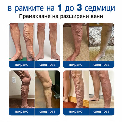 🎁 🎁 Останаха само 5 кутии! Сега предлагаме допълнителна отстъпка от 50%! Останете във форма и здрави.